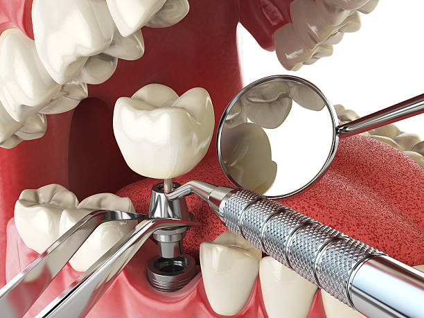 Best Urgent Tooth Repair  in Pigeon Forge, TN